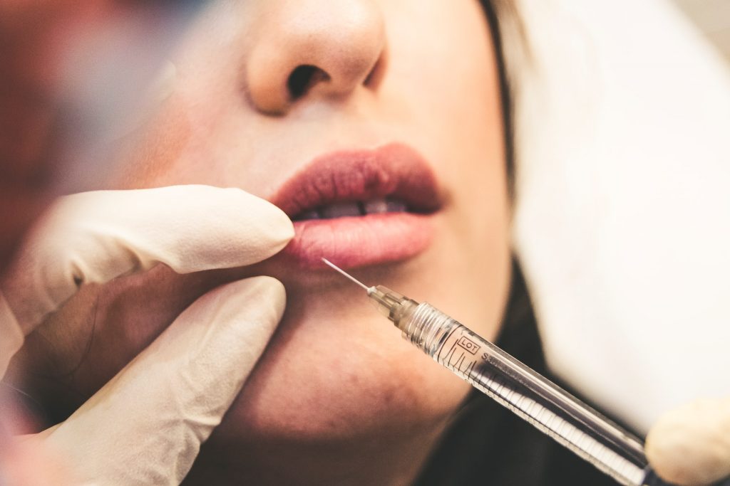Lady receiving lip filler injections